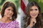 Kristi Noem's Plastic Surgery Journey