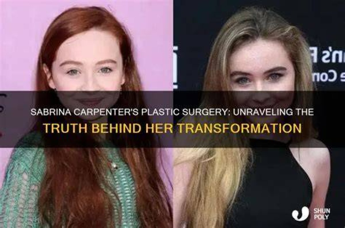The Truth About Sabrina Carpenter's Plastic Surgery Rumors