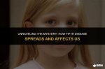Unraveling the Mystery: What Disease Does Shannon Bream Have?